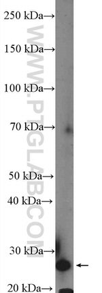 XRCC6BP1 Antibody in Western Blot (WB)