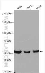 TrpRS Antibody in Western Blot (WB)