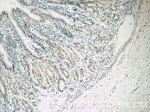 PCIF1 Antibody in Immunohistochemistry (Paraffin) (IHC (P))