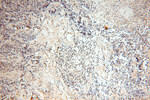 PCIF1 Antibody in Immunohistochemistry (Paraffin) (IHC (P))