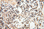 PCIF1 Antibody in Immunohistochemistry (Paraffin) (IHC (P))