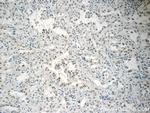 PCIF1 Antibody in Immunohistochemistry (Paraffin) (IHC (P))