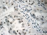 PCIF1 Antibody in Immunohistochemistry (Paraffin) (IHC (P))
