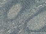 PCIF1 Antibody in Immunohistochemistry (Paraffin) (IHC (P))