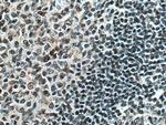 PCIF1 Antibody in Immunohistochemistry (Paraffin) (IHC (P))