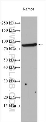 PCIF1 Antibody in Western Blot (WB)