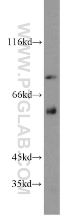 PCIF1 Antibody in Western Blot (WB)