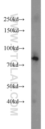 NOL9 Antibody in Western Blot (WB)