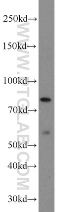 NOL9 Antibody in Western Blot (WB)