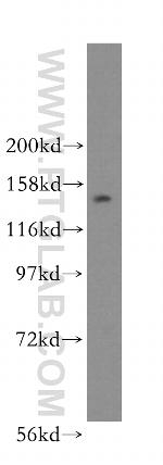 NUP160 Antibody in Western Blot (WB)