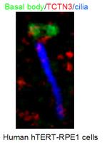 TCTN3 Antibody in Immunocytochemistry (ICC/IF)