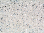 RPL23 Antibody in Immunohistochemistry (Paraffin) (IHC (P))