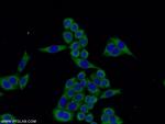 TMEM141 Antibody in Immunocytochemistry (ICC/IF)