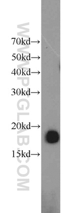 POLR2D Antibody in Western Blot (WB)