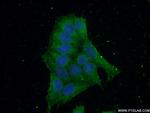 KPTN Antibody in Immunocytochemistry (ICC/IF)