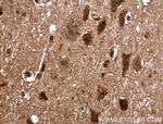 BRMS1 Antibody in Immunohistochemistry (Paraffin) (IHC (P))