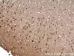BRMS1 Antibody in Immunohistochemistry (Paraffin) (IHC (P))
