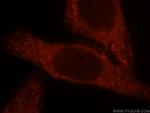 BBOX1 Antibody in Immunocytochemistry (ICC/IF)