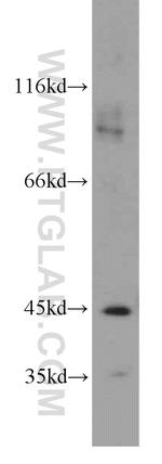 BBOX1 Antibody in Western Blot (WB)