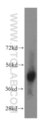 BBOX1 Antibody in Western Blot (WB)