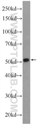 CGRRF1 Antibody in Western Blot (WB)