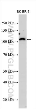 Telethonin Antibody in Western Blot (WB)