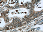 S100A4 Antibody in Immunohistochemistry (Paraffin) (IHC (P))