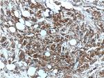 S100A4 Antibody in Immunohistochemistry (Paraffin) (IHC (P))