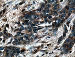 GS28 Antibody in Immunohistochemistry (Paraffin) (IHC (P))