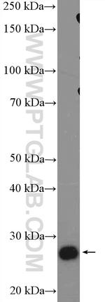 GS28 Antibody in Western Blot (WB)