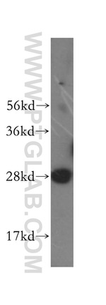 GS28 Antibody in Western Blot (WB)