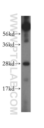 GS28 Antibody in Western Blot (WB)