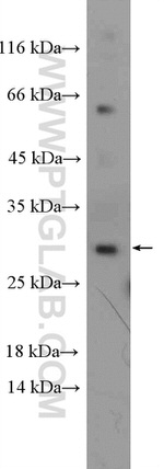 GS28 Antibody in Western Blot (WB)