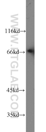 HSF1 Antibody in Western Blot (WB)