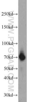 HSF1 Antibody in Western Blot (WB)