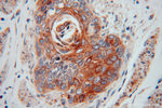 ERGIC1 Antibody in Immunohistochemistry (Paraffin) (IHC (P))