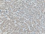 ERGIC1 Antibody in Immunohistochemistry (Paraffin) (IHC (P))