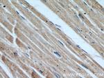 COPG2 Antibody in Immunohistochemistry (Paraffin) (IHC (P))