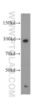 COPG2 Antibody in Western Blot (WB)
