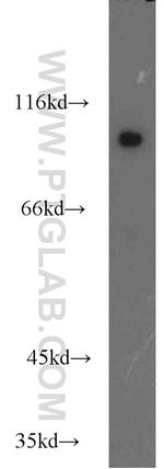 COPG2 Antibody in Western Blot (WB)