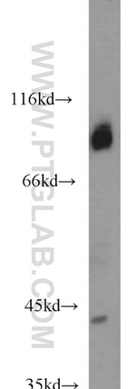 COPG2 Antibody in Western Blot (WB)