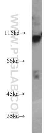 COPG2 Antibody in Western Blot (WB)
