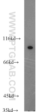 COPG2 Antibody in Western Blot (WB)