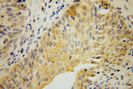 MTHFD1L Antibody in Immunohistochemistry (Paraffin) (IHC (P))