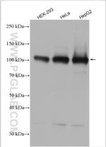 MTHFD1L Antibody in Western Blot (WB)