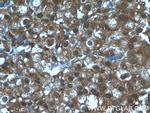 EIF4A2 Antibody in Immunohistochemistry (Paraffin) (IHC (P))