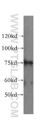 RLIM Antibody in Western Blot (WB)