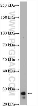 ARHGDIB Antibody in Western Blot (WB)