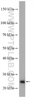 ARHGDIB Antibody in Western Blot (WB)