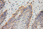 ARHGDIB Antibody in Immunohistochemistry (Paraffin) (IHC (P))